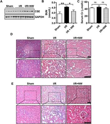 Norswertianolin Promotes Cystathionine γ-Lyase Activity and Attenuates Renal Ischemia/Reperfusion Injury and Hypertension